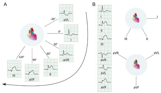 Svensk EKG-presentation är logisk och lättförståelig