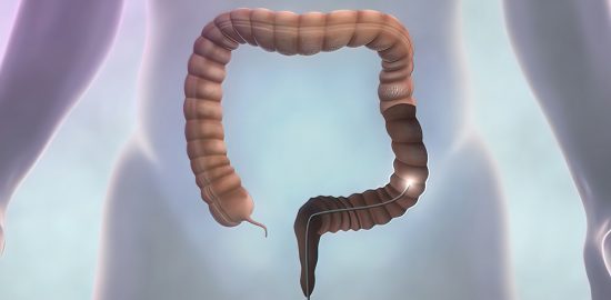 Maskininlärning användes för att förbättra upptäckt av tarmcancer