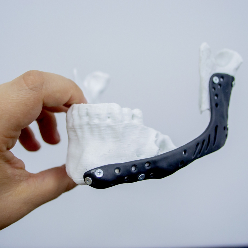 Uppsala prøver 3D-printing i helsevesenet