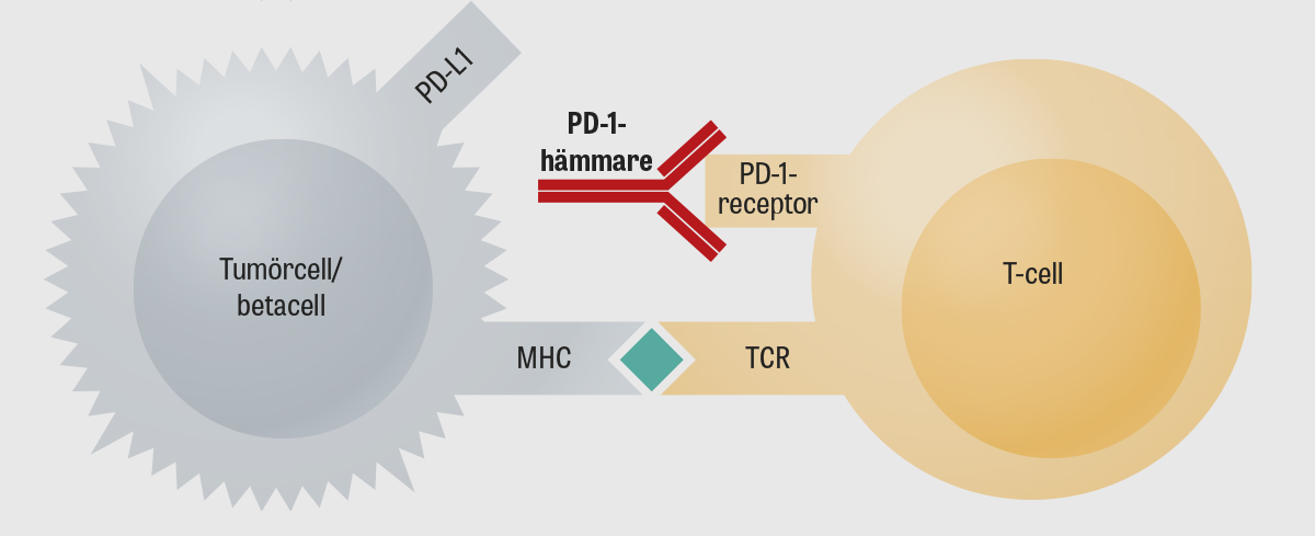 Diabetisk ketoacidose kan utløses ved behandling med PD-1-hemmere