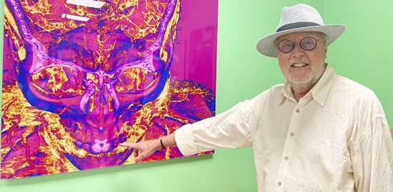 Han gifter ihop det medicinska med det konstnärliga i DT-bilder