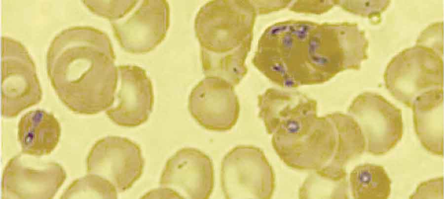 Babesia-infektion kan vara vanligare i Sverige än vi tidigare trott