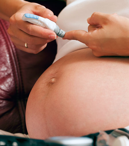 Ökad risk för prematuritet hos gravida med typ 1-diabetes