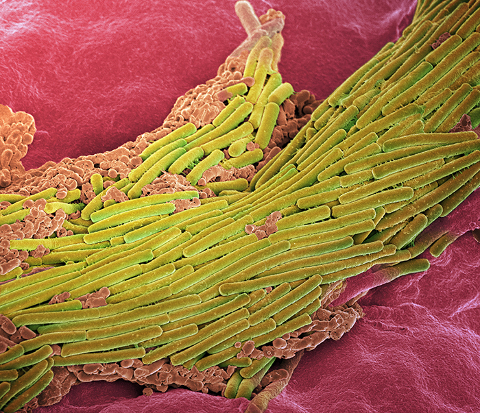 Jakten på giftämnet från Clostridium difficile