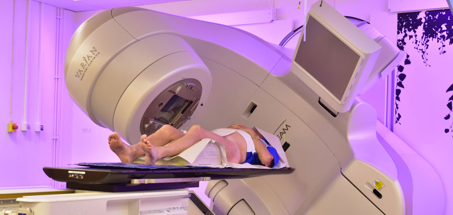 Kort och intensiv strålbehandling var effektivt vid prostatacancer